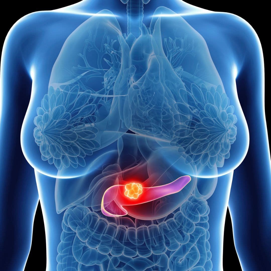Understanding the Diagnosis Process for Pancreatic Cancer