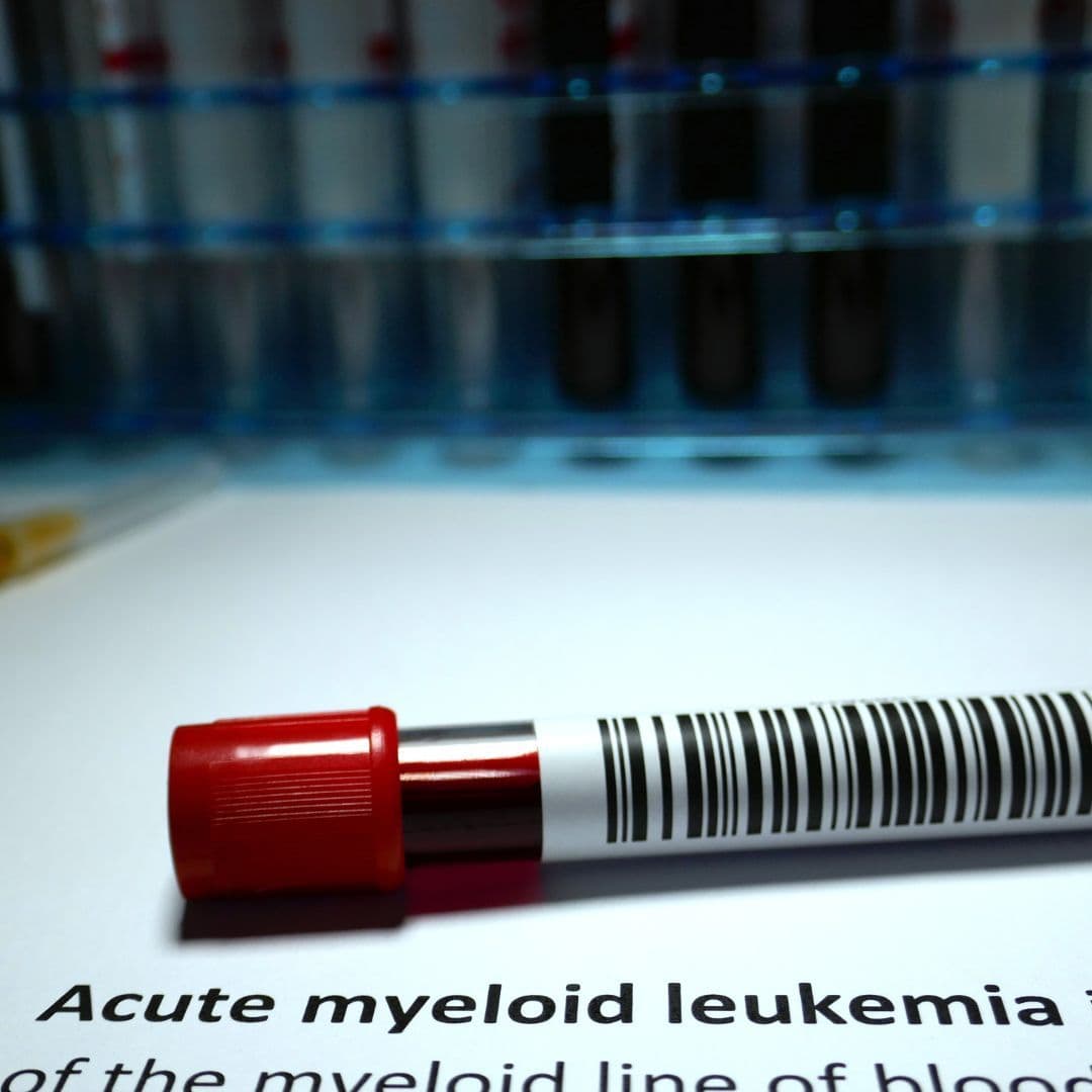 A Detailed Guide through a Leukemia Diagnosis
